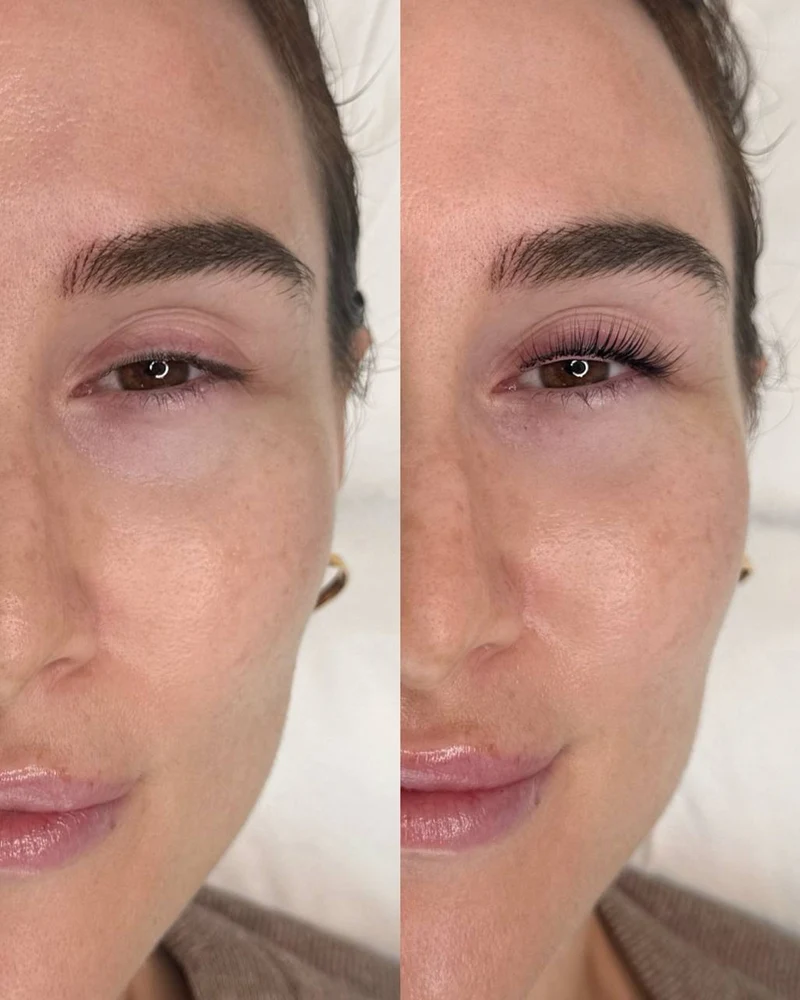 Lash Lift Before and After - Profile